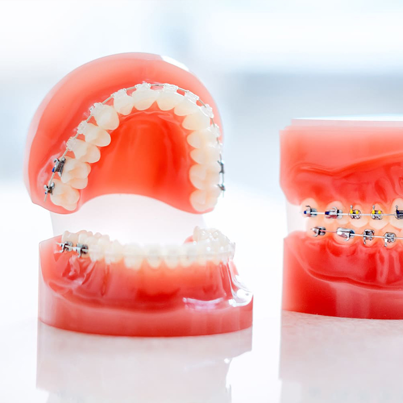 ORTHO/矯正治療